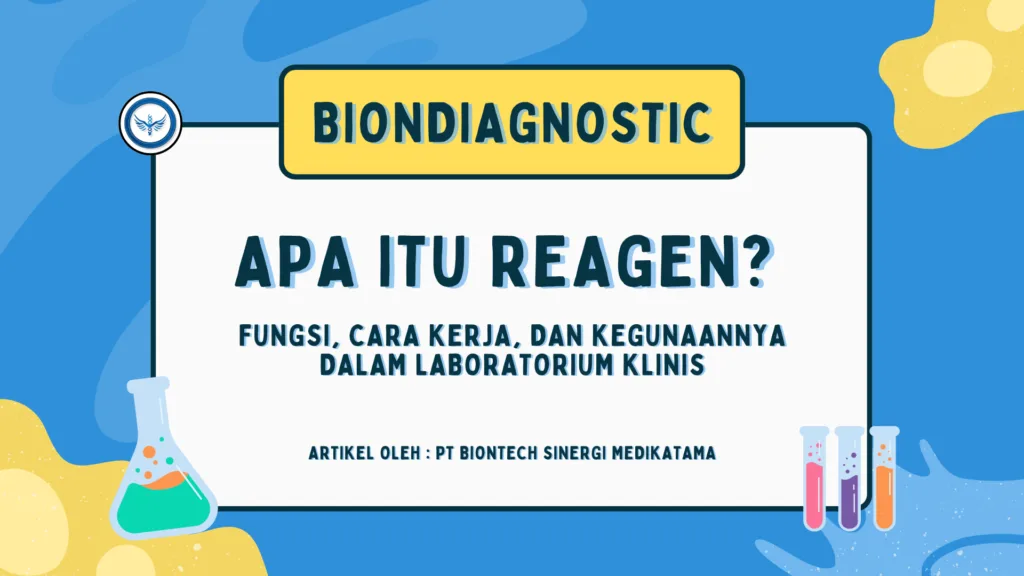 Reagen Laboratorium - Biondiagnostic